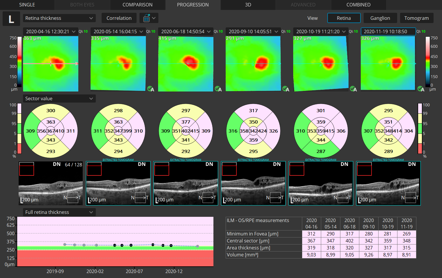 Progression Quantification 1 1 1