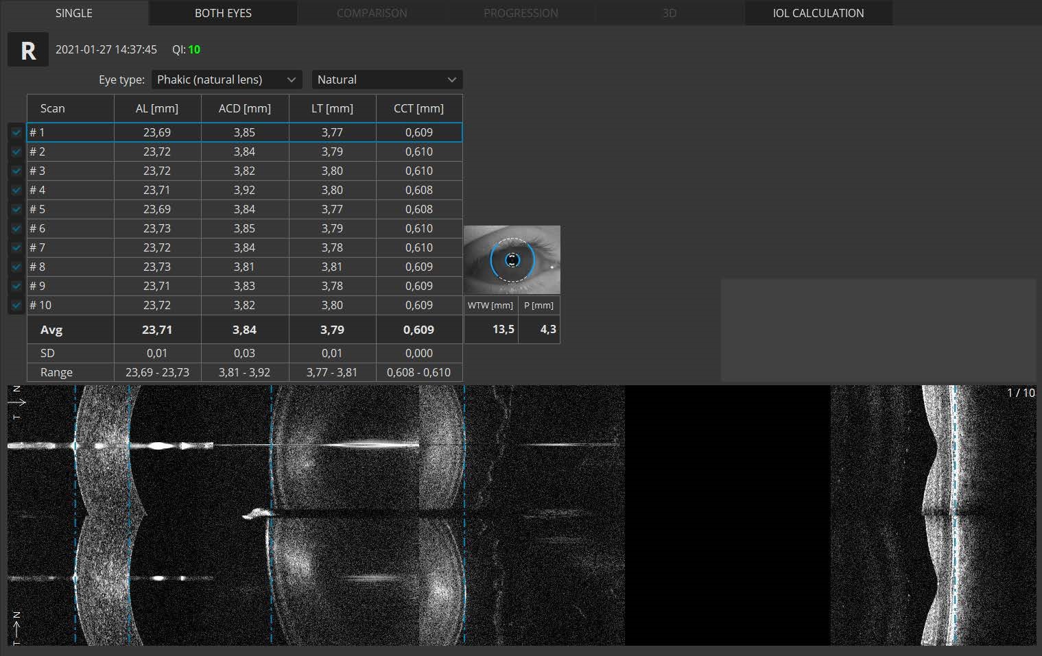 biometry