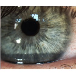 Slit Lamp Imaging